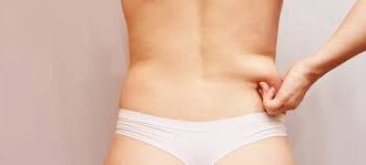 6 Reasons to Have a Liposuction