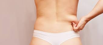 6 Reasons to Have a Liposuction