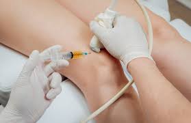 Combating Osteoarthritis with PRP Therapy: A Patient’s Journey