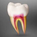 Differences Between a Pediatric Root Canal and an Adult Root Canal