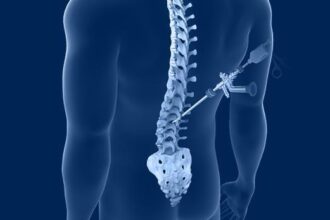 Different Types of Spine Surgery Procedures