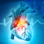 How Cardiologists Diagnose and Treat Heart Conditions