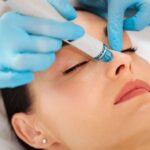The Ultimate Guide to Hydrafacials for Glowing Skin