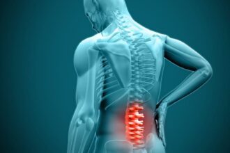 When Is Disc Surgery the Best Option for Your Condition?