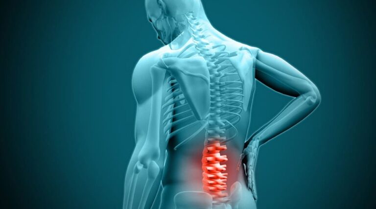 When Is Disc Surgery the Best Option for Your Condition?