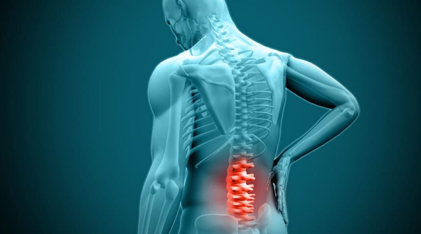 When Is Disc Surgery the Best Option for Your Condition?