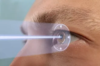 Contoura LASIK
