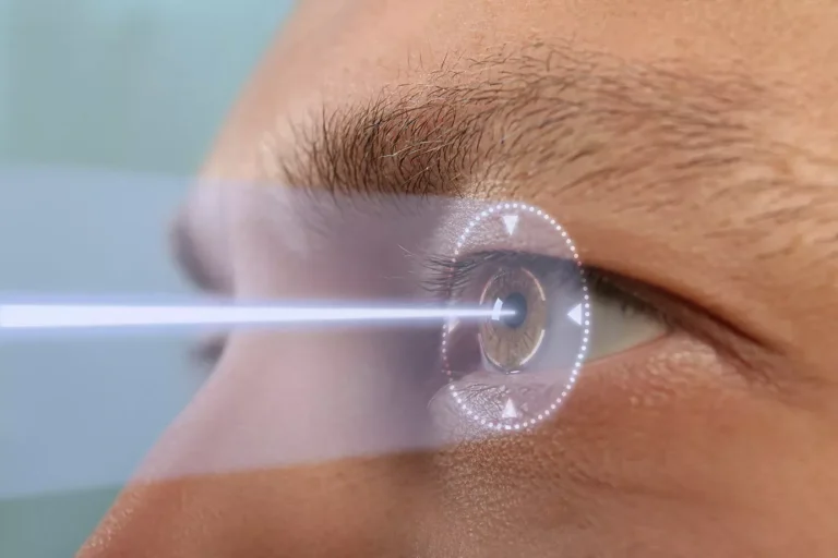 Contoura LASIK