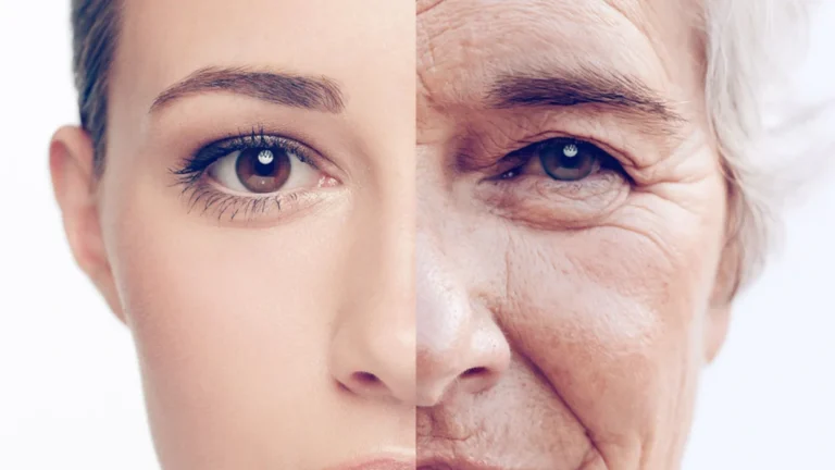 Effects of Aging