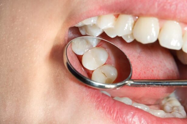Fillings for Your Teeth