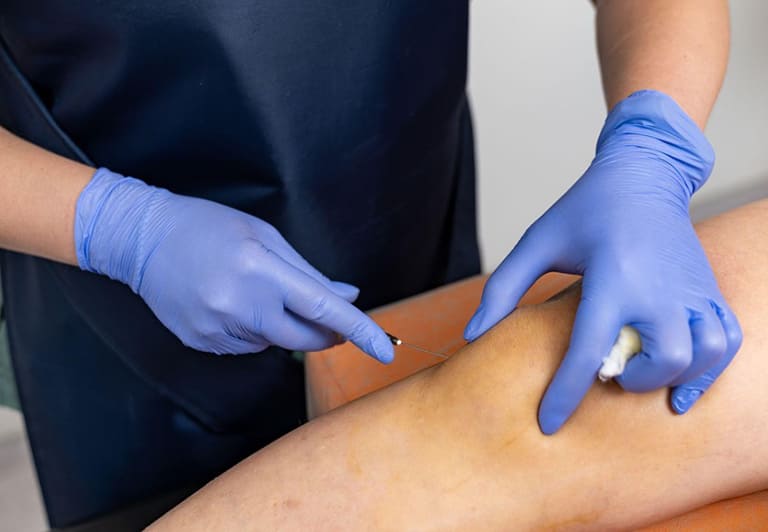 Benefits of PRP Injections