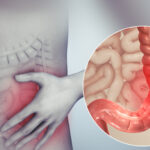 Causes of IBS