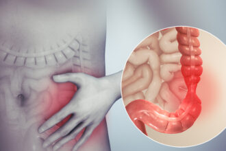 Causes of IBS
