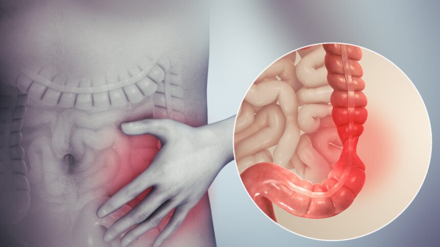 Causes of IBS