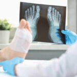 Complex Foot Deformities