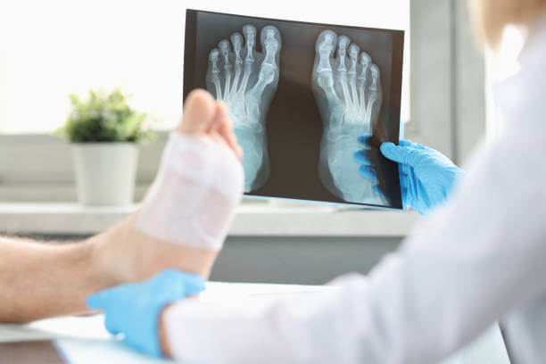 Complex Foot Deformities
