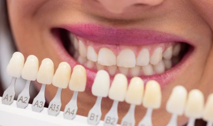 Cosmetic Dental Issues