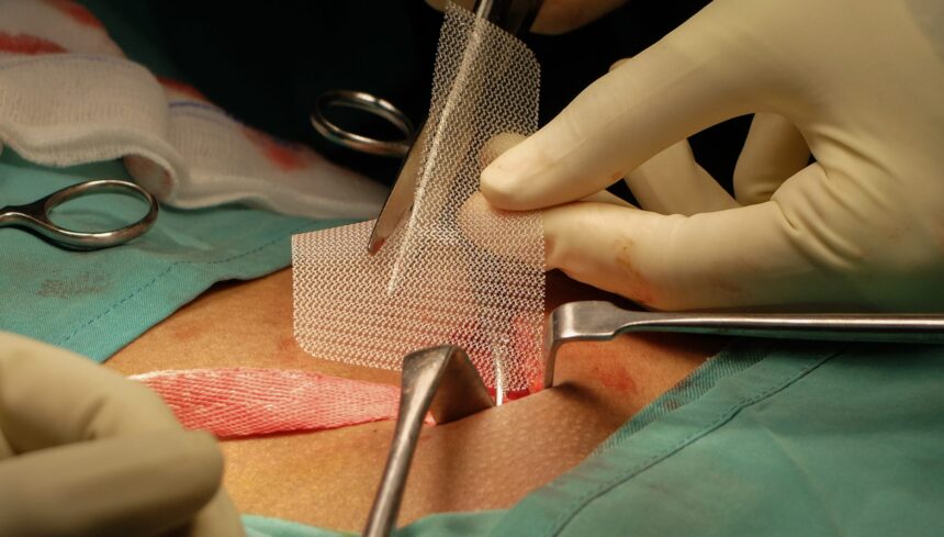 Hernia Surgery Techniques