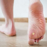 Identify and Treat Warts on Your Feet