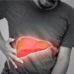Liver Disease