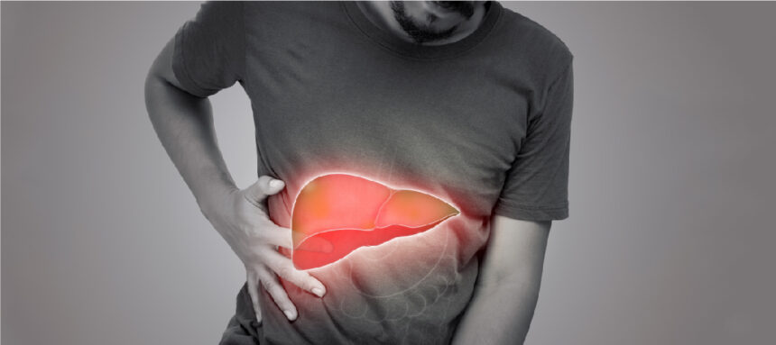 Liver Disease