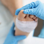 Managing Chronic Wounds