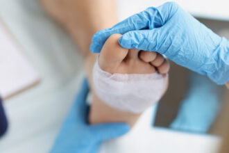 Managing Chronic Wounds
