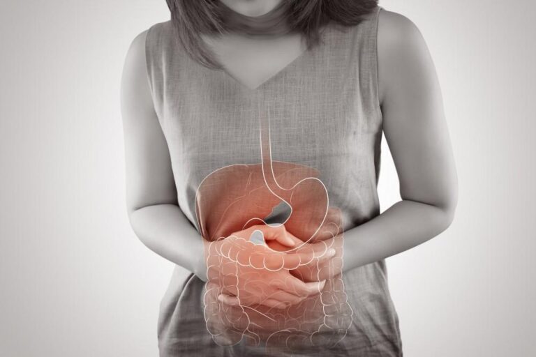Managing Crohn's Disease Symptoms