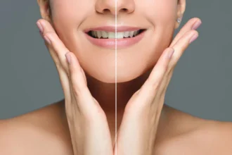 Professional Teeth Whitening