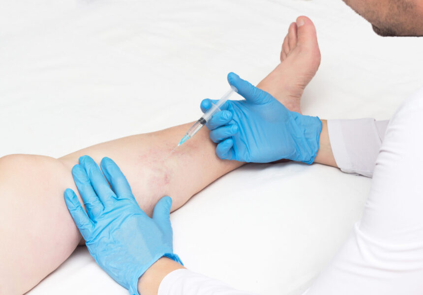 Vein Clinic Consultation