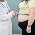 Weight Loss Surgery