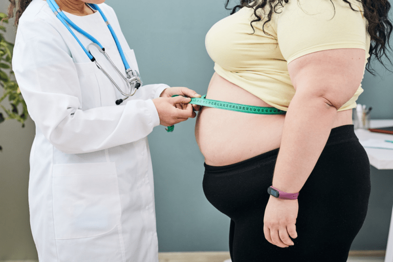 Weight Loss Surgery