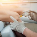 Stem Cell Therapy