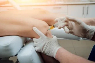 Stem Cell Therapy