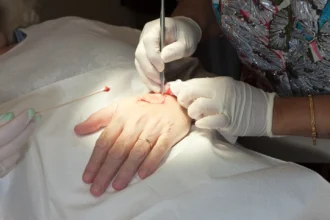Skin Cancer Surgery