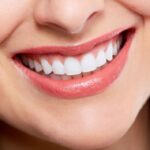 Cosmetic Dentistry for a Perfect Smile