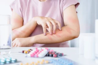 Symptoms of Drug Allergies