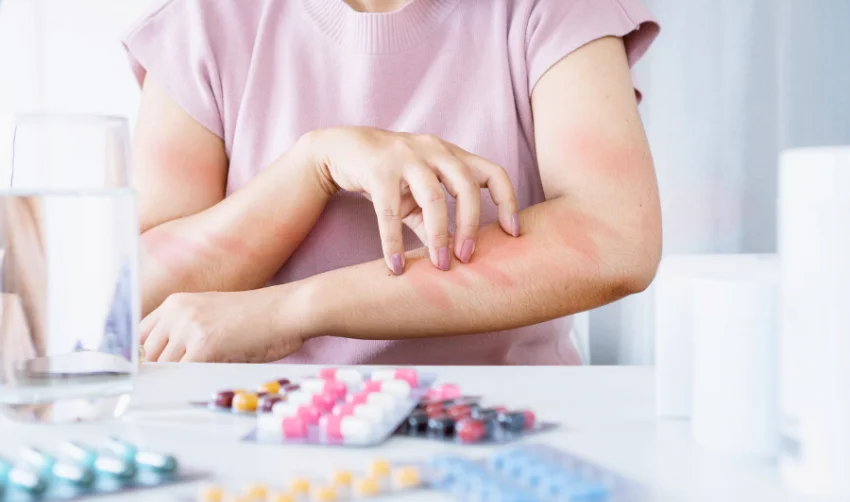 Symptoms of Drug Allergies