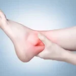 Ankle Injuries