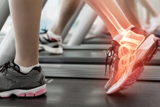 Ankle Replacement
