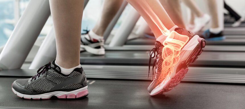 Ankle Replacement