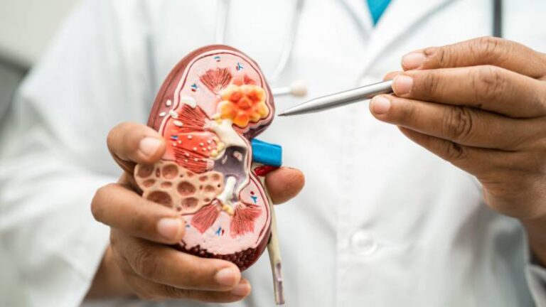 Benefits of Cryoablation for Tumor Treatment