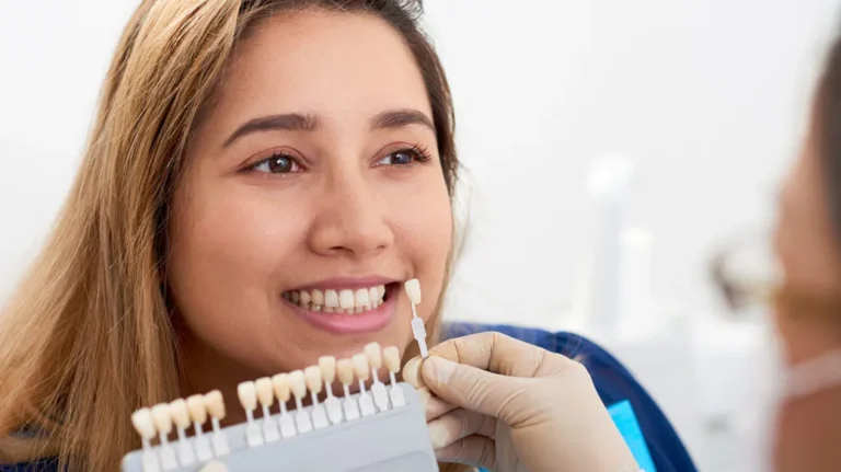 Common Dental Imperfections