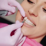 Cosmetic Dentistry