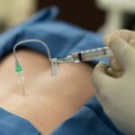 Epidural Injections for Chronic Pain
