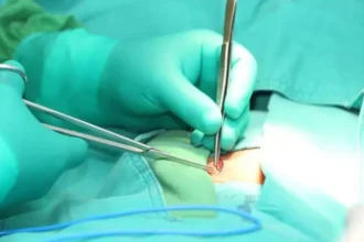 Hernia Repair Surgeon