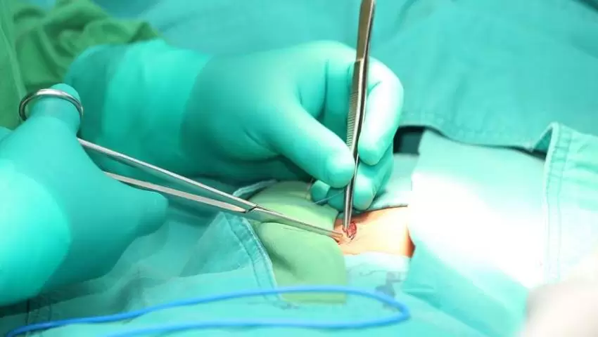 Hernia Repair Surgeon