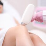 Laser Hair Removal