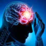 Long-term Effects of Concussions