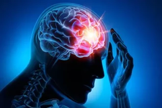 Long-term Effects of Concussions